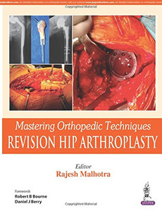 Mastering Orthopedic Techniques: Revision Total Hip Arthroplasty
