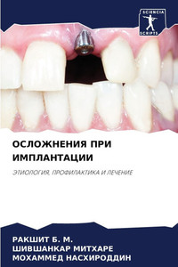 ОСЛОЖНЕНИЯ ПРИ ИМПЛАНТА&