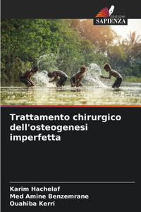 Trattamento chirurgico dell'osteogenesi imperfetta