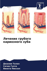 Лечение грубого кариозн&