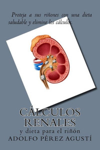 CÃ¡lculos renales: y dieta para el riÃ±Ã³n