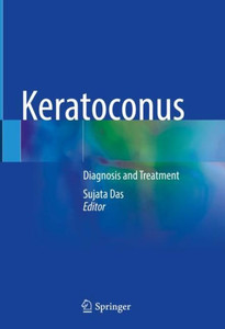 Keratoconus: Diagnosis and Treatment