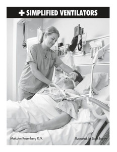 Simplified Ventilators