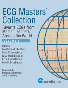 ECG Masters' Collection, Volume 2: Favorite ECGs from Master Teachers Around the World