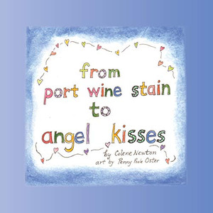 From Port Wine Stain to Angel Kisses From Port Wine Stain to Angel Kisses
