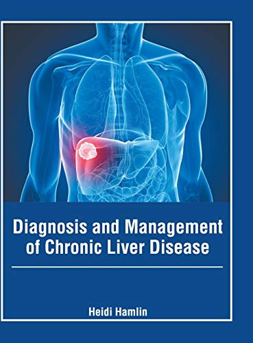 Diagnosis And Management Of Chronic Liver Disease