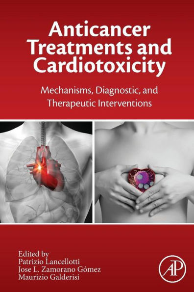 Anticancer Treatments And Cardiotoxicity: Mechanisms, Diagnostic And Therapeutic Interventions