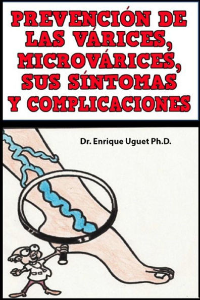 Prevencion De Las Varices, Microvarices, Sus Sintomas Y Complicaciones: (B & W) (Spanish Edition)