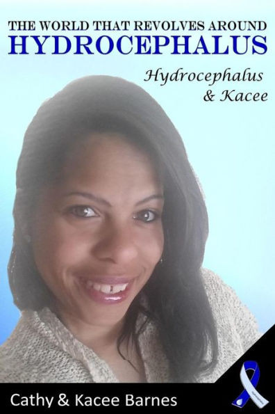 The World That Revolves Around Hydrocephalus: Hydrocephalus And Kacee