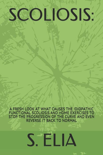 Scoliosis : : A Fresh Look At What Causes The Idiopathic Functional Scoliosis And Home Exercises To Stop The Progression Of The Curve And Even Reverse It Back To Normal