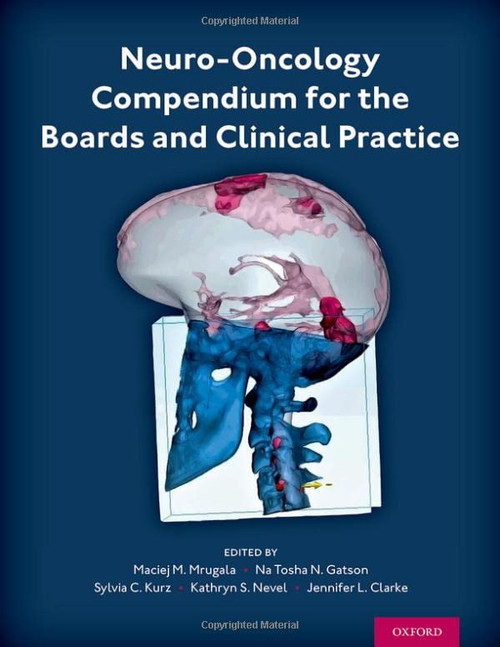Neuro-Oncology Compendium For The Boards And Clinical Practice