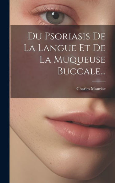 Du Psoriasis De La Langue Et De La Muqueuse Buccale... (French Edition)