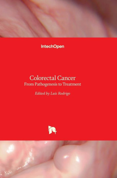 Colorectal Cancer : From Pathogenesis to Treatment