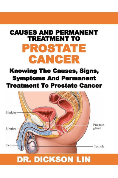 Causes and Permanent Treatment to Prostate Cancer: Knowing The Causes, Signs, Symptoms And Permanent Treatment To Prostate Cancer