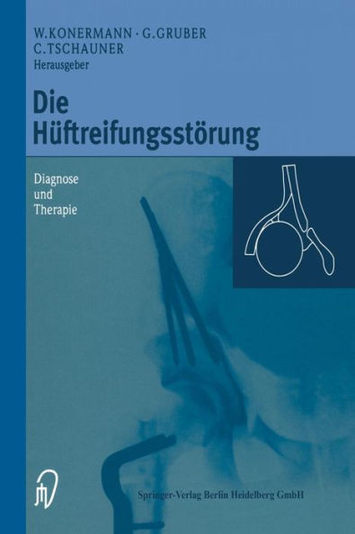 Die Hüftreifungsstörung: Diagnose Und Therapie