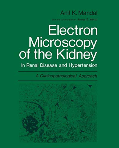 Electron Microscopy Of The Kidney: In Renal Disease And Hypertension: A Clinicopathological Approach