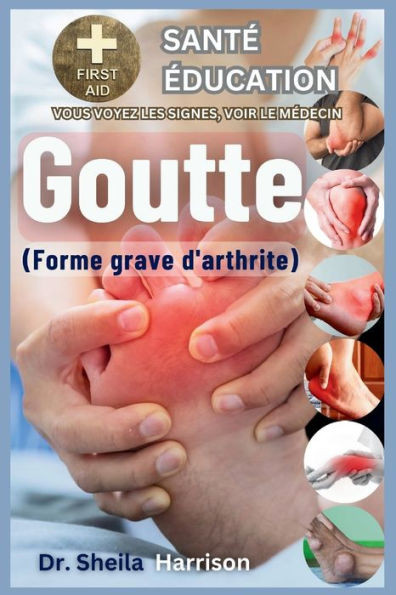 Goutte: forme grave d'arthrite: Causes, symptÃ´mes, gestion des modificateurs de risque, traitement, mÃ©dicaments, prÃ©vention, a