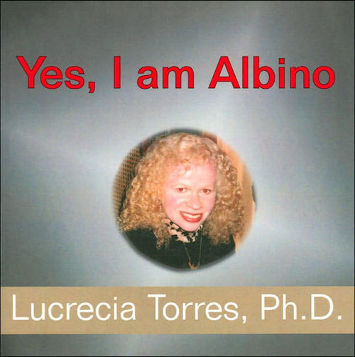 Yes, I Am Albino