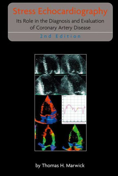 Stress Echocardiography: Its Role in the Diagnosis and Evaluation of Coronary Artery Disease