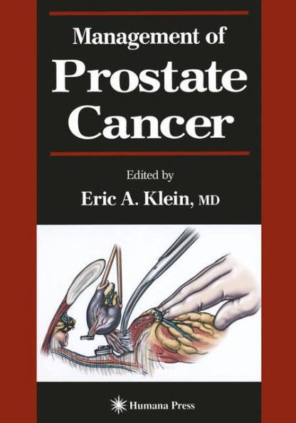 Management of Prostate Cancer
