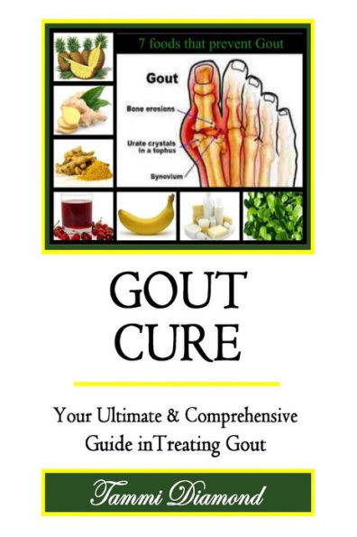 Gout Cure: Your Ultimate and Comprehensive Guide in Treating Gout