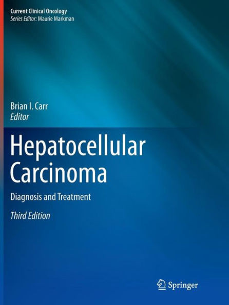 Hepatocellular Carcinoma: Diagnosis and Treatment