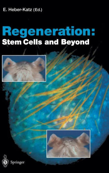 Regeneration: Stem Cells and Beyond