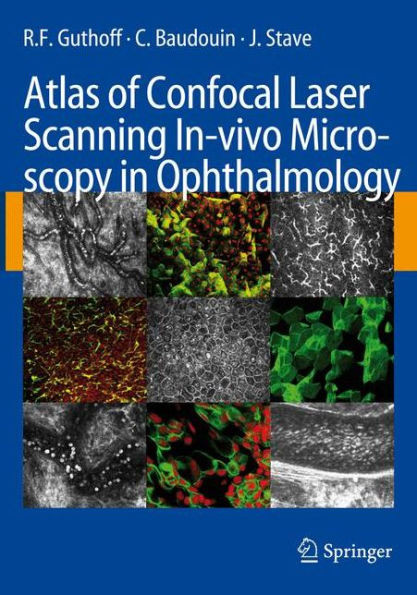 Atlas of Confocal Laser Scanning In-Vivo Microscopy in Ophthalmology: Principles and Applications in Diagnostic and Therapeutic Ophtalmology