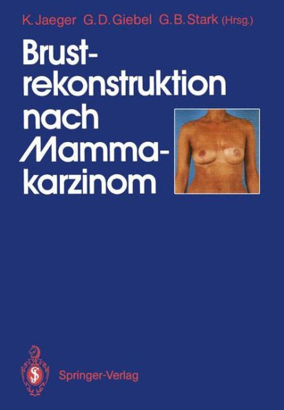 Brustrekonstruktion Nach Mammakarzinom