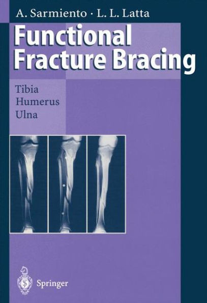 Functional Fracture Bracing: Tibia, Humerus, and Ulna