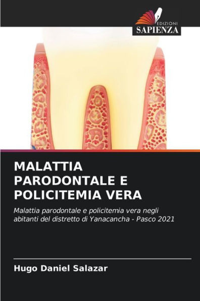 Malattia Parodontale E Policitemia Vera