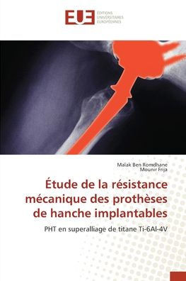 Étude de la résistance mécanique des prothèses de hanche implantables
