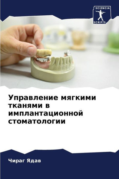Управление мягкими ткан&
