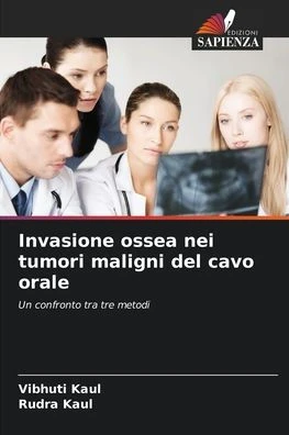 Invasione ossea nei tumori maligni del cavo orale