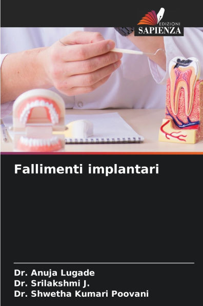Fallimenti implantari