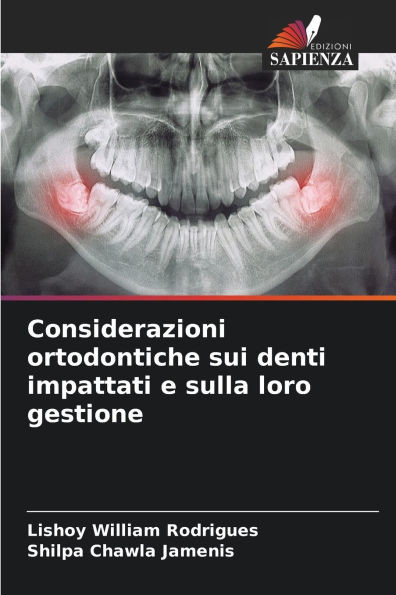 Considerazioni ortodontiche sui denti impattati e sulla loro gestione