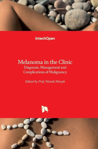 Melanoma in the Clinic: Diagnosis, Management and Complications of Malignancy