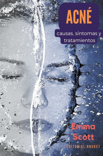 AcnÃ©: Causas, SÃ­ntomas y Tratamientos