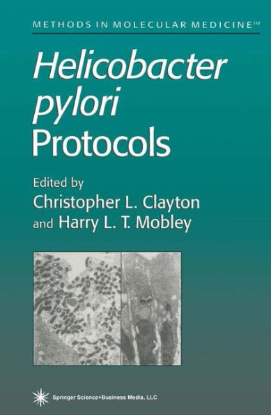 Helicobacter Pylori Protocols
