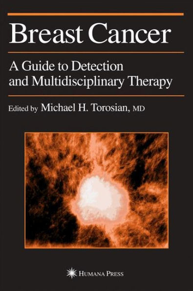 Breast Cancer: A Guide to Detection and Multidisciplinary Therapy