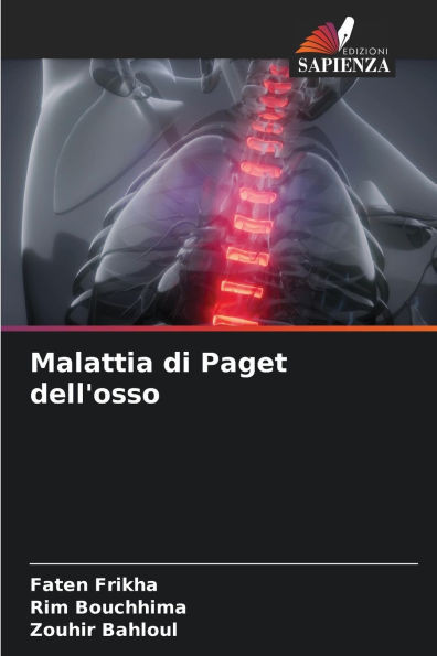 Malattia di Paget dell'osso