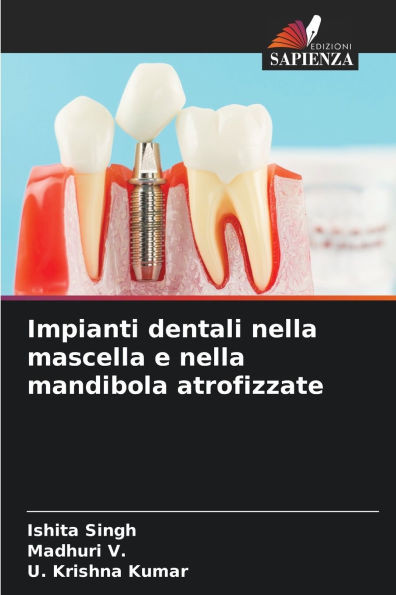 Impianti dentali nella mascella e nella mandibola atrofizzate