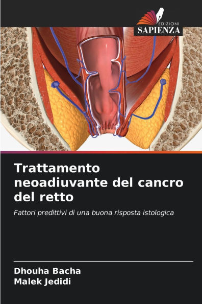 Trattamento neoadiuvante del cancro del retto