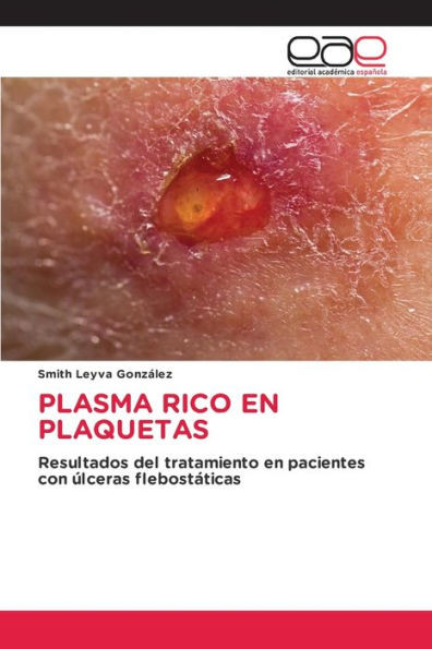 Plasma Rico En Plaquetas
