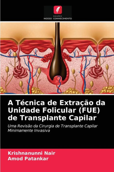A TÃ©cnica de ExtraÃ§Ã£o da Unidade Folicular (FUE) de Transplante Capilar