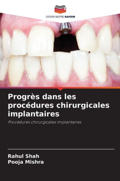 ProgrÃ¨s dans les procÃ©dures chirurgicales implantaires