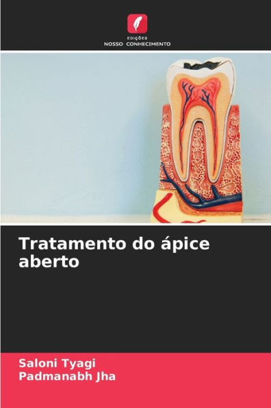 Tratamento do Ã¡pice aberto
