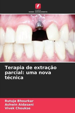 Terapia de extraÃ§Ã£o parcial: uma nova tÃ©cnica