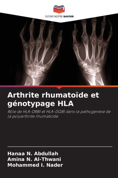 Arthrite rhumatoÃ¯de et gÃ©notypage HLA