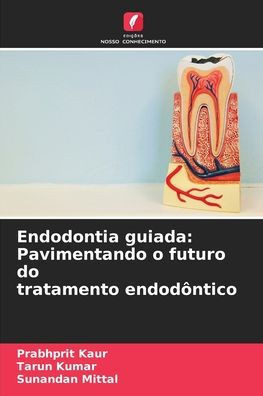 Endodontia guiada: Pavimentando o futuro do tratamento endodôntico
